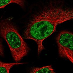 UCK Antibody, Novus Biologicals:Antibodies:Primary Antibodies